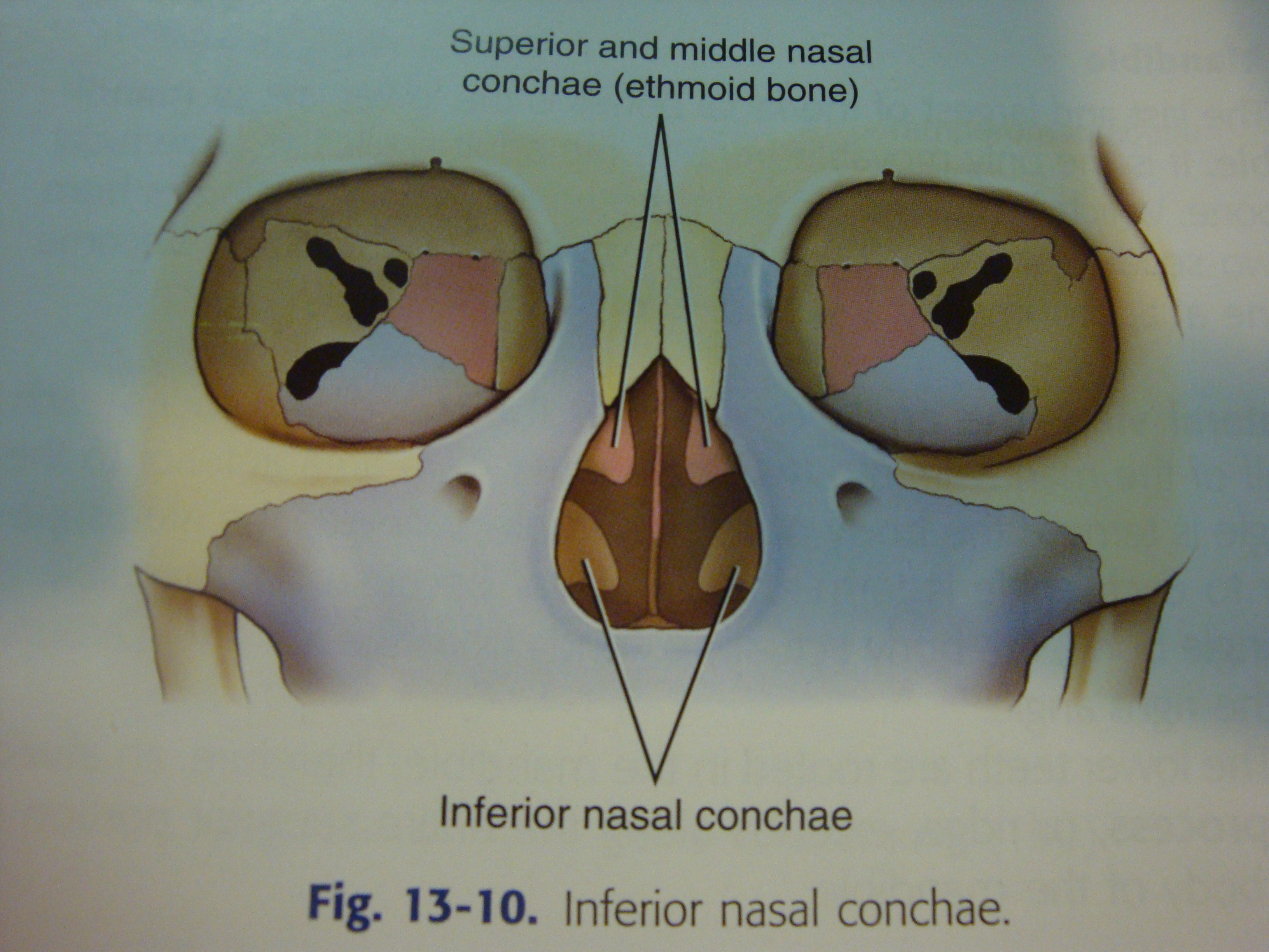 New CMAP for Facial Bones and Parasinuses